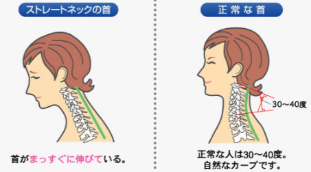 %e3%82%b9%e3%83%88%e3%83%ac%e3%83%bc%e3%83%88%e3%83%8d%e3%83%83%e3%82%af